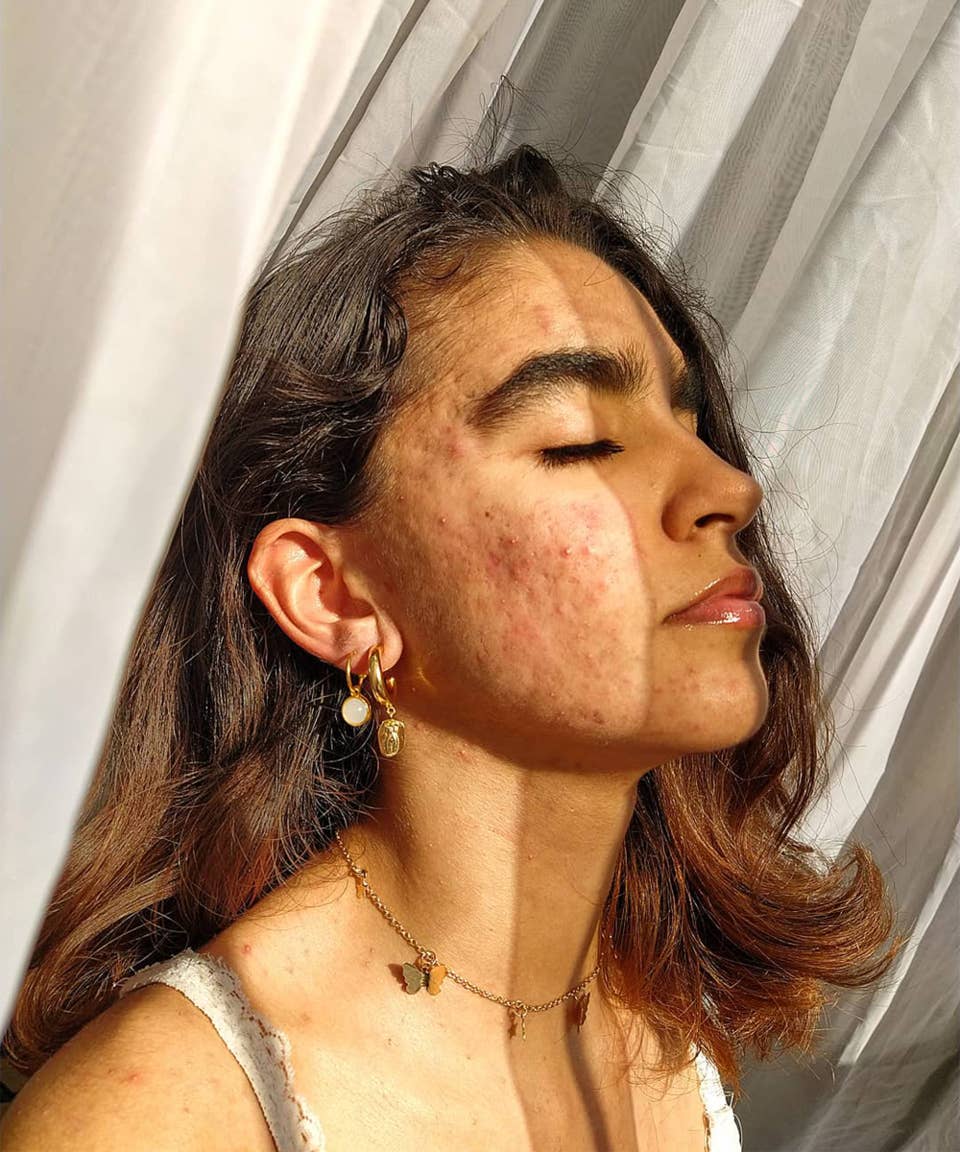 Accutane pille