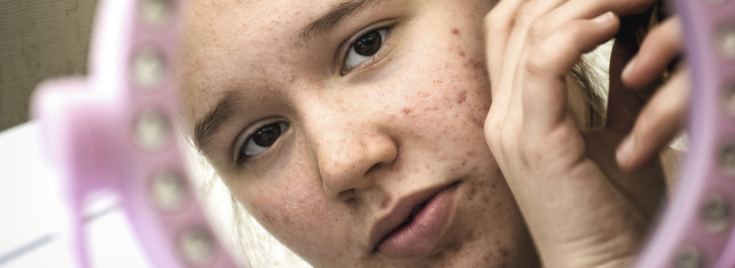 Bestellen roaccutan generika