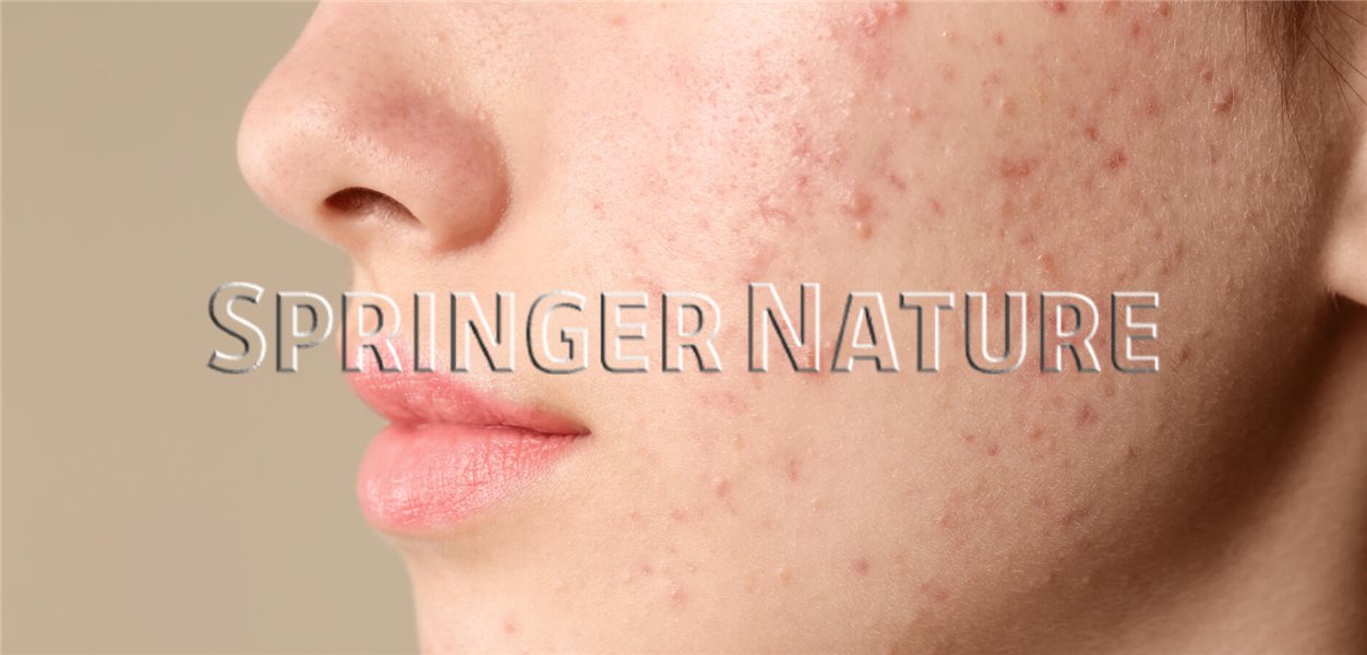 Isotretinoin akne kaufen