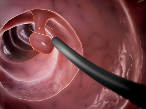 viagra generika ohne rezept bestellen