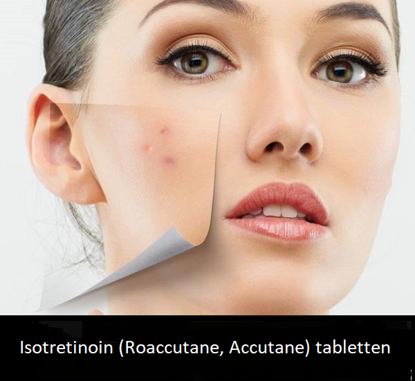 Wie Isotretinoin Kaufen